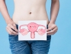 Ung thư buồng trứng giai đoạn cuối: Làm sao để kéo dài thời gian sống?